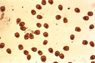 echinococcus_Mae Melvin